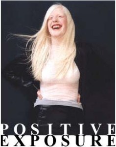 When You Are Different, the World is Full of Ignorant Morons, Especially on&nbsp;Twitter